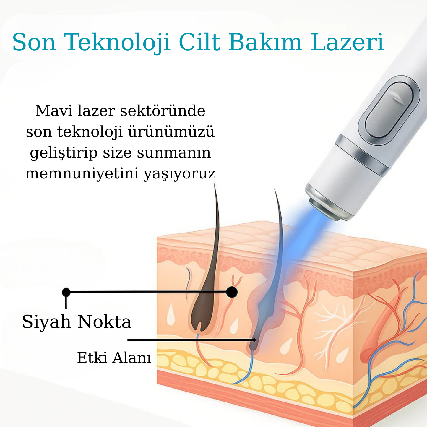 Zeriova Cilt Bakım Lazeri